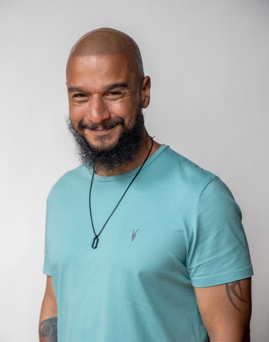 Scalp micropigmentation result at Erik Roberto SMP Studio