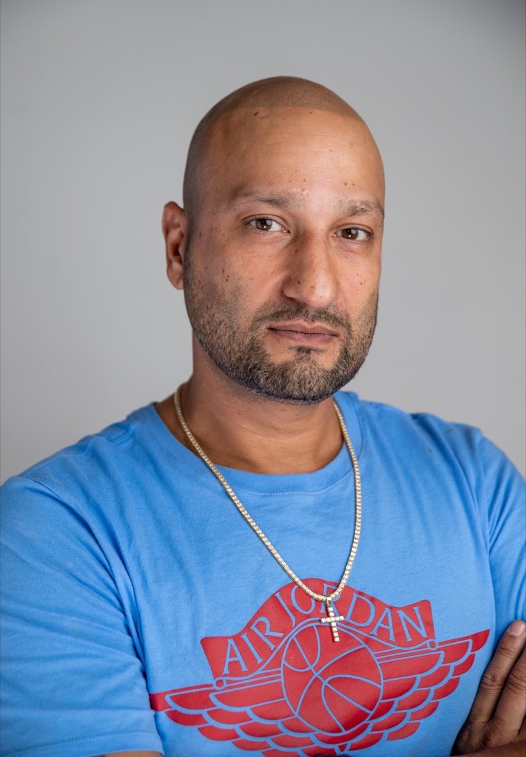 Scalp micropigmentation result at Erik Roberto SMP Studio