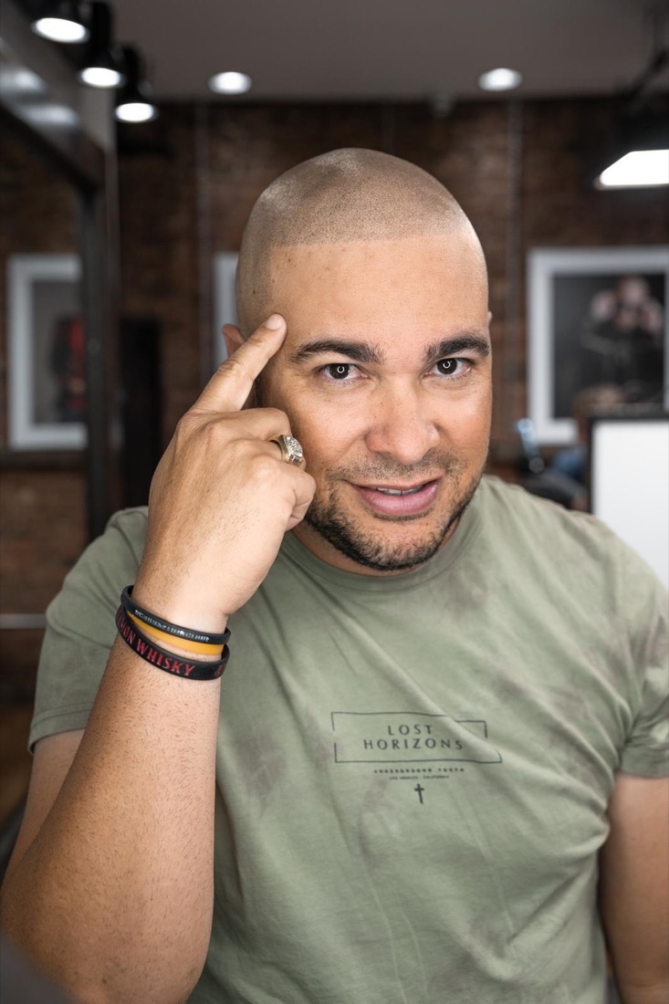 Scalp micropigmentation result at Erik Roberto SMP Studio